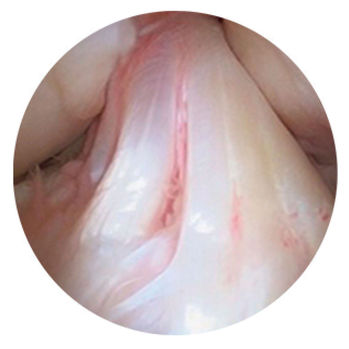 Ligamento
