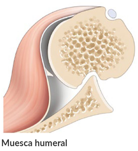 Image: /images/articulos/hombro/10_preguntas_clave_luxacion_hombro/img-2.jpg
