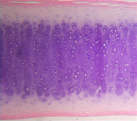 Image: /images/articulos/rodilla/10_preguntas_clave_cartilago_articular/img-4.jpg