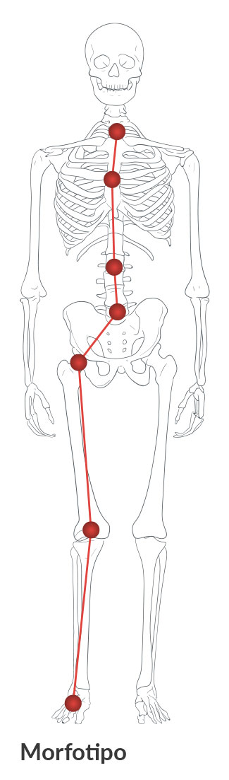 Image: /images/articulos/rodilla/10_preguntas_clave_ligamento_cruzado_anterior_mujer/img-2.jpg
