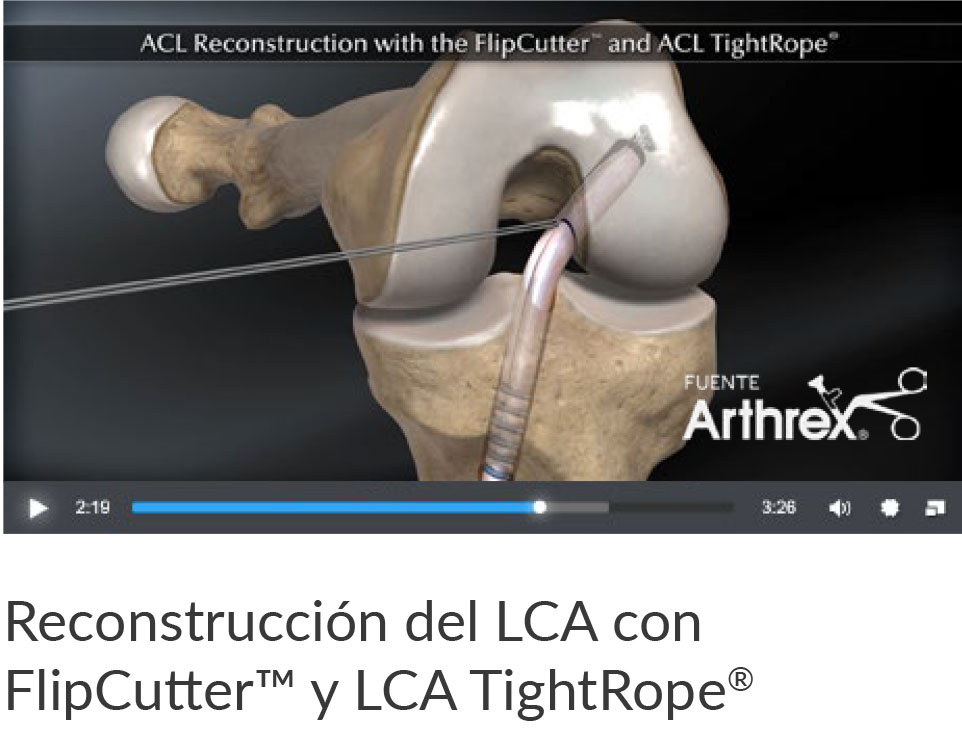 Image: /images/articulos/rodilla/10_preguntas_clave_ligamento_cruzado_anterior_nino/img-5.jpg