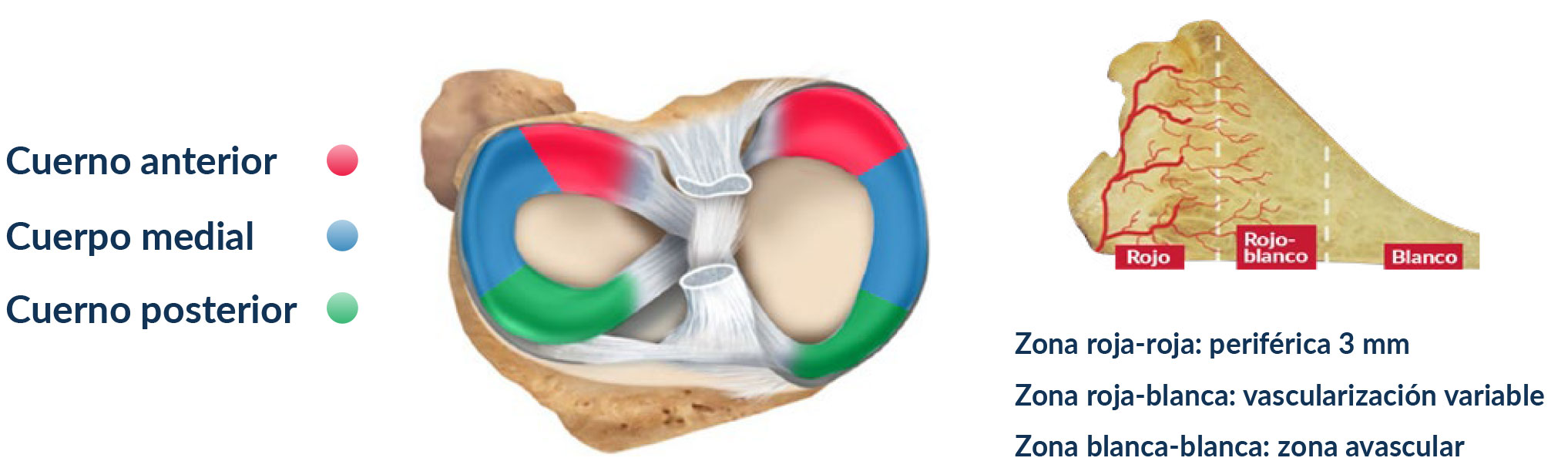 Image: /images/articulos/rodilla/10_preguntas_clave_menisco/img-1.jpg