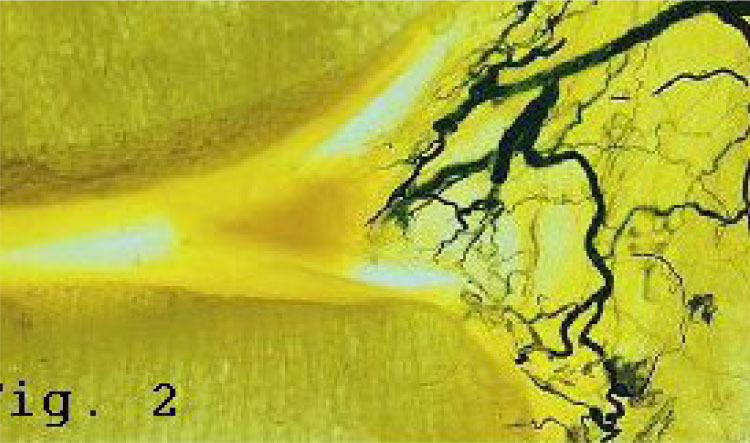 Image: /images/articulos/rodilla/10_preguntas_clave_menisco/img-2.jpg
